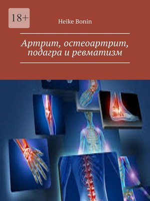 cover image of Артрит, остеоартрит, подагра и ревматизм